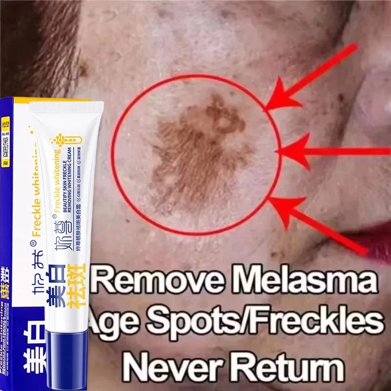 Potente crema sbiancante per l - Skincare Korea recensione e prezzo