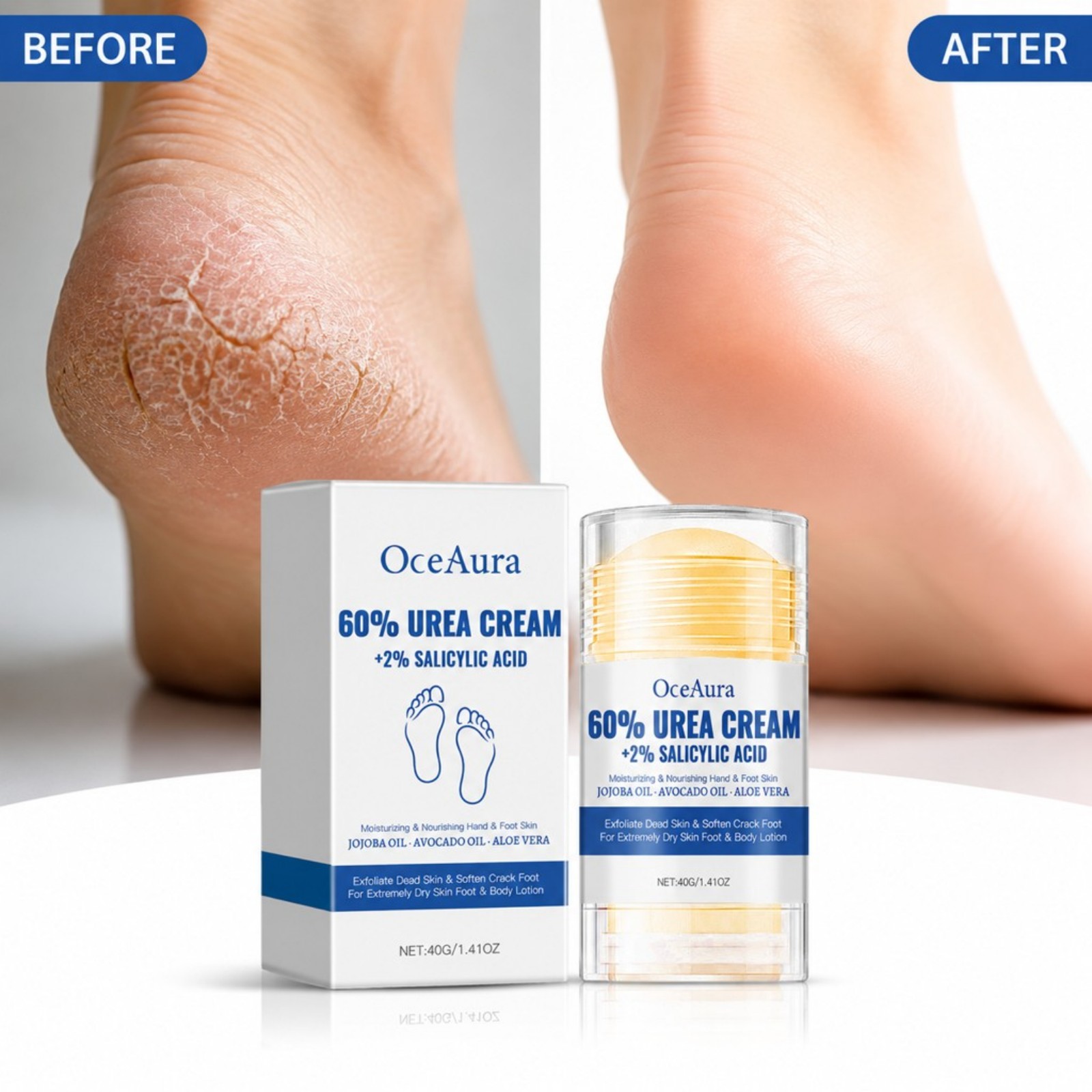 Crema per la Cura dei Piedi co - Urea Foot Cream recensione e prezzo