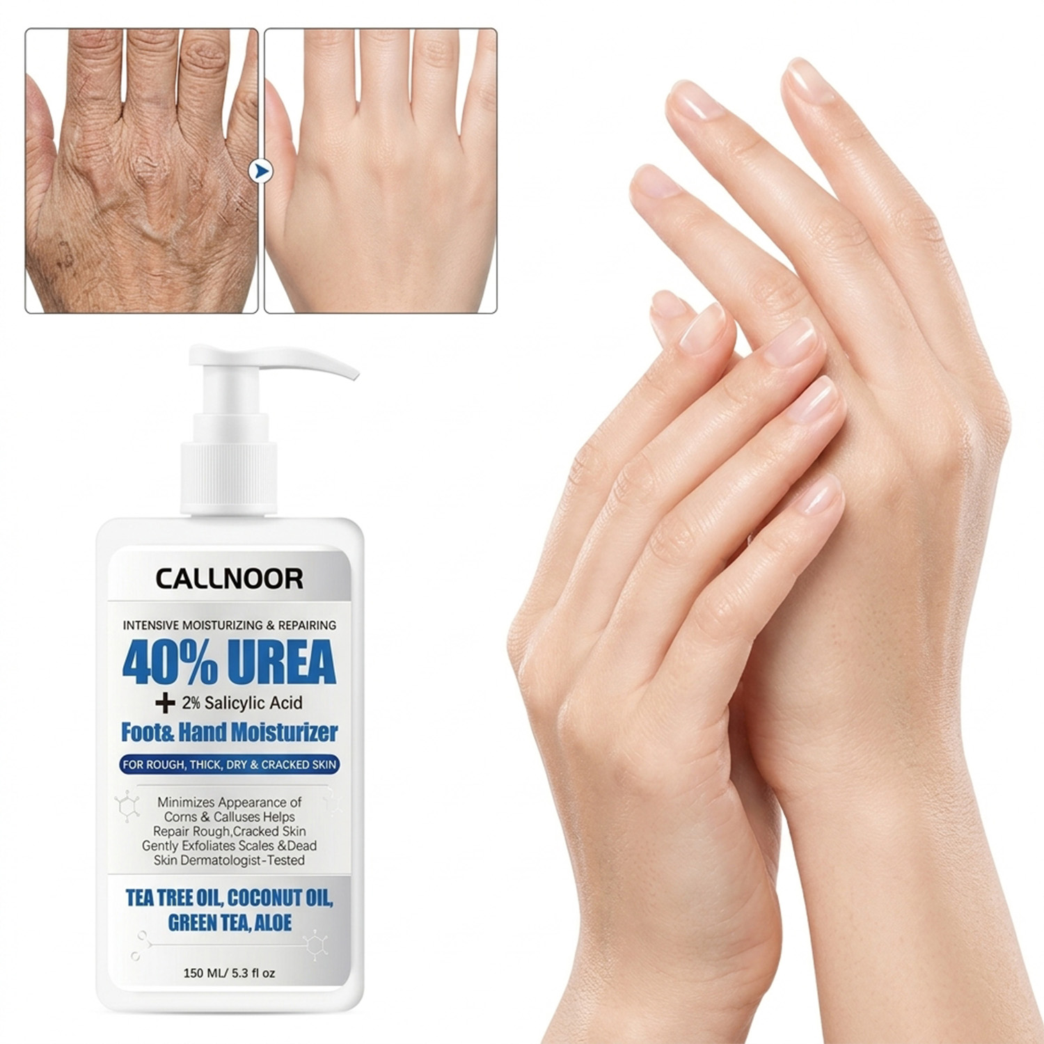 Crema per Mani e Piedi 0% Urea - Urea Foot Cream recensione e prezzo